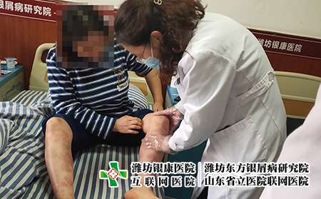 濰坊治療皮膚病院是哪家-濰坊治皮膚病到哪個專業(yè) 濰坊治療皮膚病院是哪家-濰坊治皮膚病到哪個專業(yè)