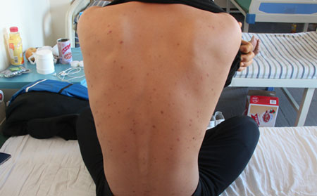 濰坊皮膚病醫(yī)院口碑