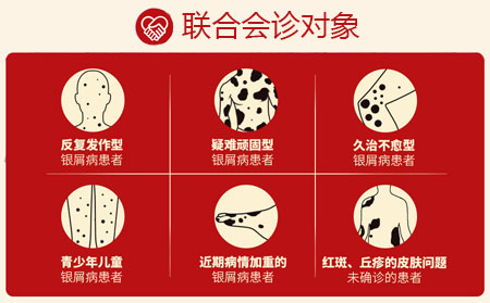 2021銀屑病聯(lián)合會診對象