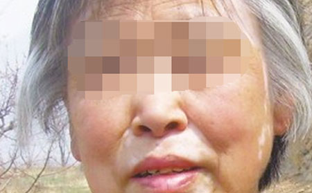 腿部白癜風(fēng),白癜風(fēng)預(yù)防,白癜風(fēng)常識(shí)