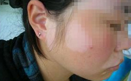 治白癜風(fēng),濰坊治白癜風(fēng),治療白癜風(fēng)醫(yī)院,白癜風(fēng)哪家醫(yī)院專業(yè)