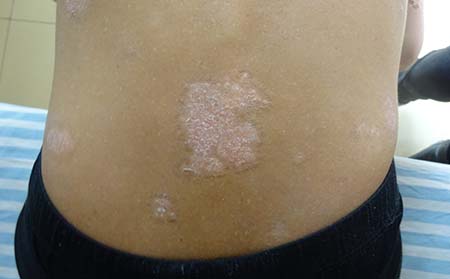 濰坊銀康醫(yī)院,濰坊銀康醫(yī)院在哪兒