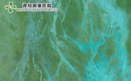 小兒過敏性紫癜的發(fā)病因素有哪些?可以吃紫薯嗎?